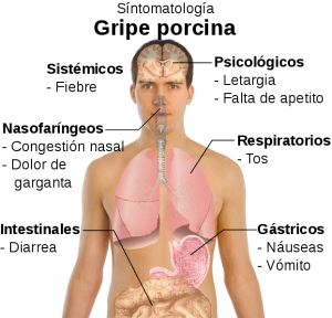 Vómitos congestión nasal dolor de cabeza